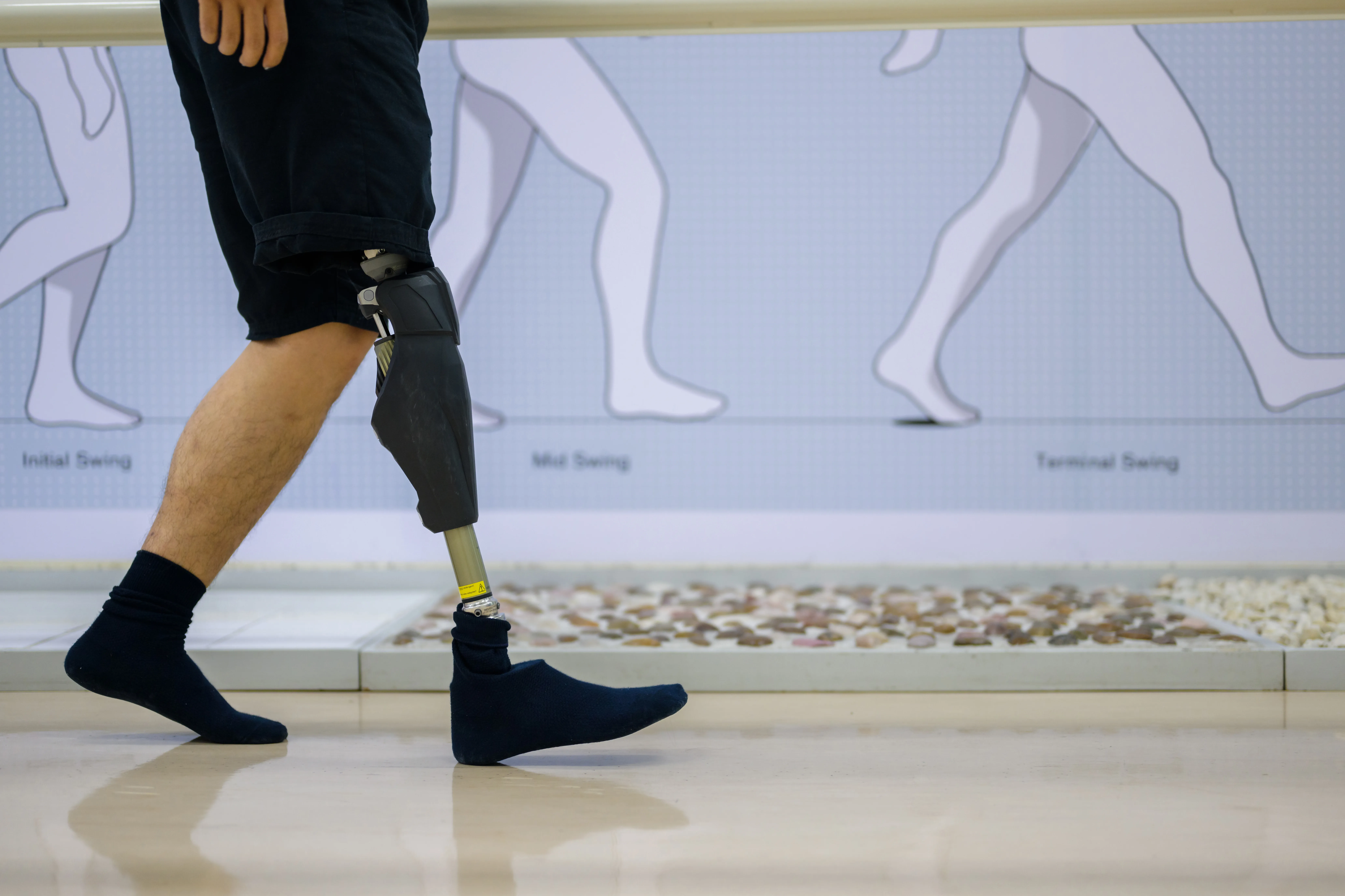 Gait Analysis
